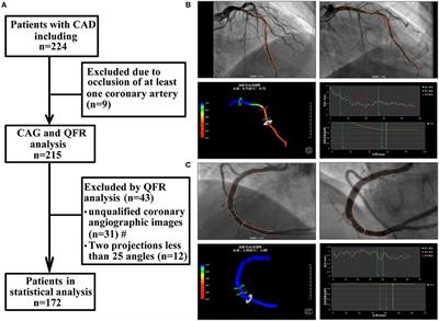 Relationship Between Immunoinflammation and Coronary Physiology Evaluated by Quantitative Flow Ratio in Patients With Coronary Artery Disease